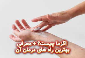 اگزما-چیست؟+معرفی-بهترین-راه-های-درمان-آن