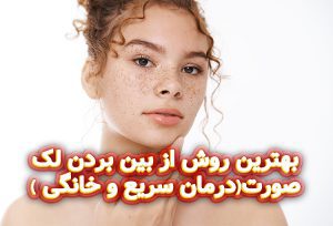بهترین-روش-از-بین-بردن-لک-صورت(درمان-سریع-و-خانگی)