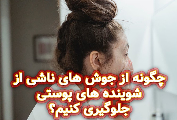 چگونه-از-جوش-های-ناشی-از-شوینده-های-پوستی-جلوگیری-کنیم؟