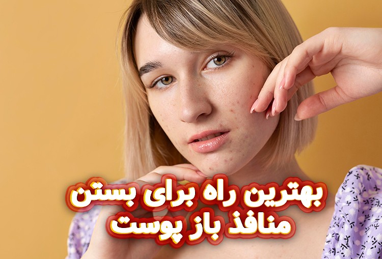 بهترین-راه-برای-بستن-منافذ-باز-پوست