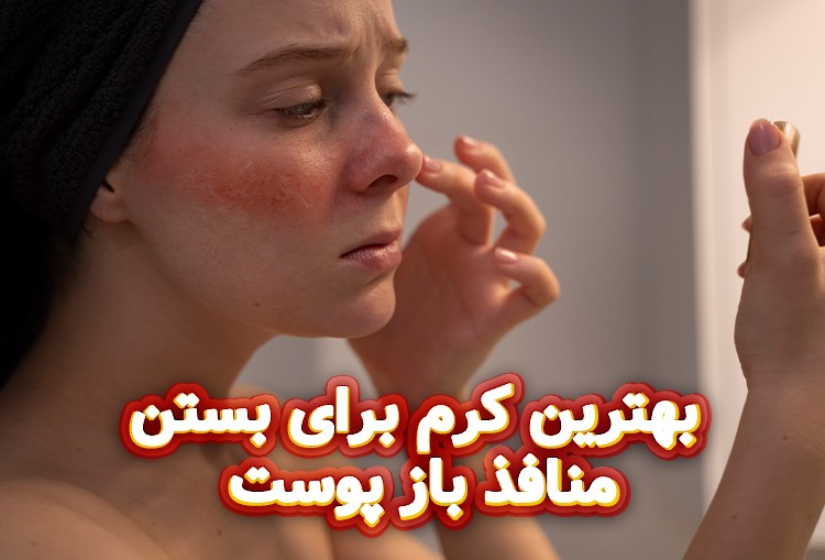 بهترین-کرم-برای-بستن-منافذ-باز-پوست
