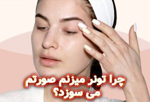 چرا-تونر-میزنم-صورتم-می-سوزد؟