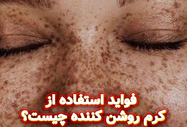 فواید-استفاده-از-کرم-روشن-کننده-چیست؟