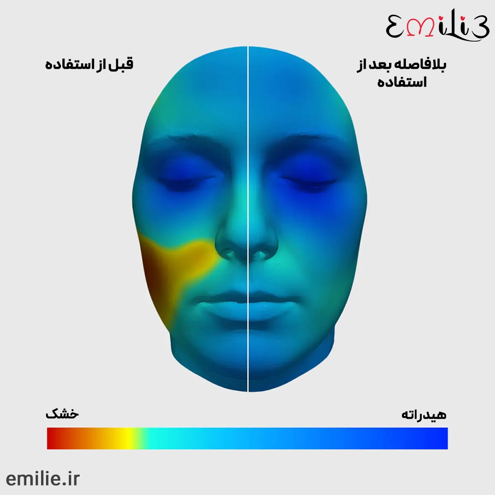 ژل آبرسان مویسچر سرج 100 ساعته کلینیک