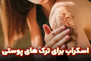 اسکراب برای ترک های پوستی