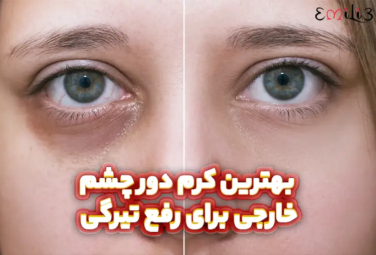 بهترین کرم دور چشم خارجی برای رفع تیرگی