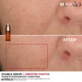 سرم جوان ساز Double Serum کلارنس
