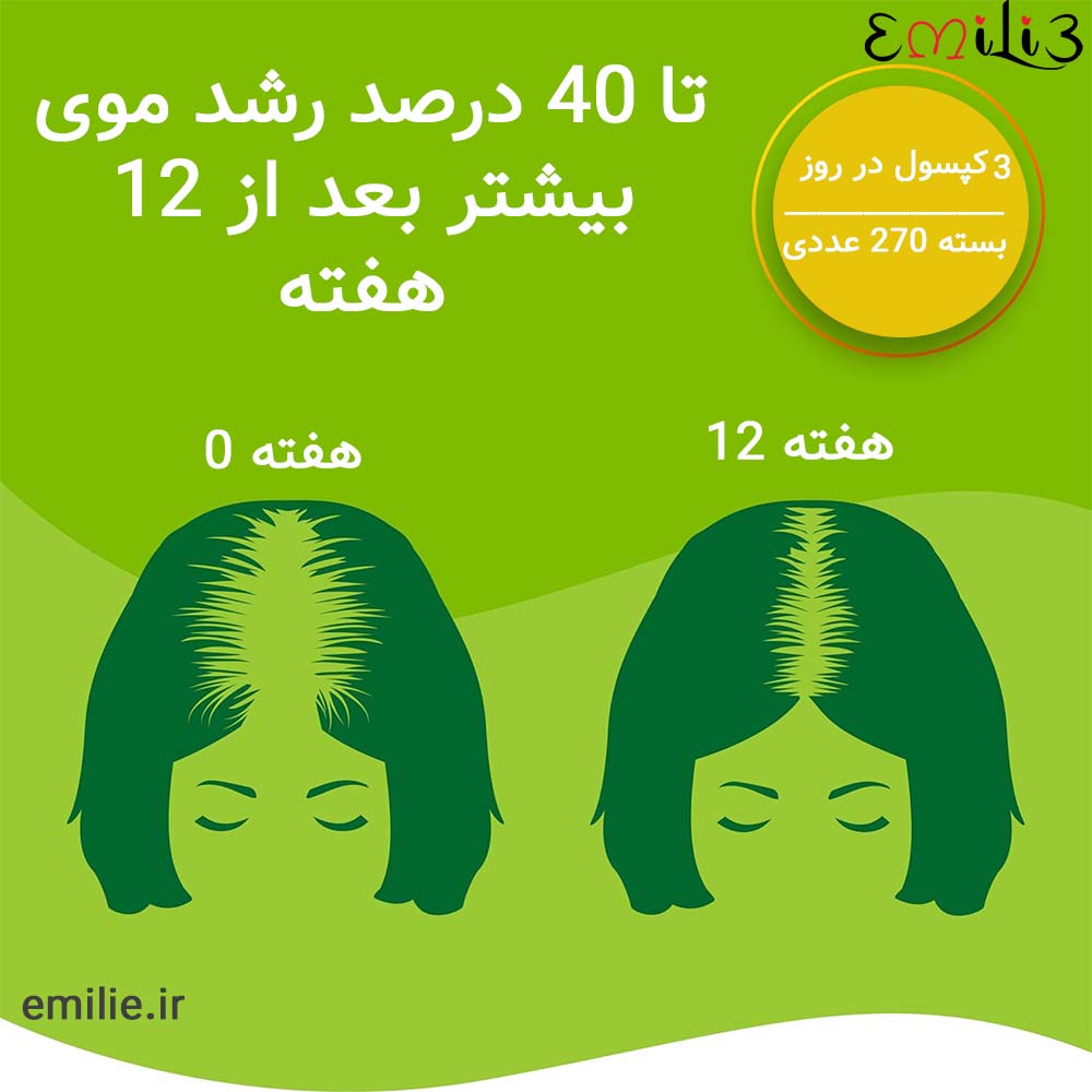 کپسول پریورین1