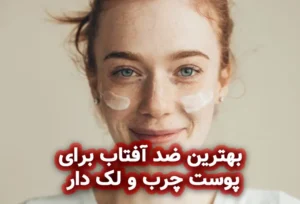 معرفی بهترین ضد آفتاب برای پوست چرب و لک دار