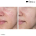 کرم آبرسان و مرطوب کننده سرامید ایلیون