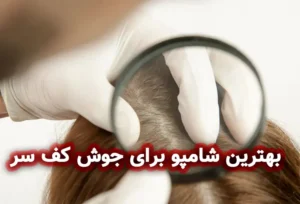 بهترین شامپو برای جوش سر