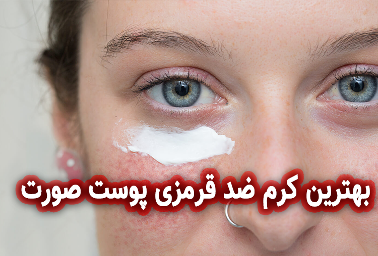 بهترین کرم ضد قرمزی پوست صورت