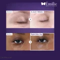 کرم دور چشم ضد چروک نامبوزین شماره 9 حاوی NAD+ و رتینال