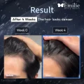 آمپول و سرم تقویت کننده مو اگزوزوم پرایم لیلیوئه